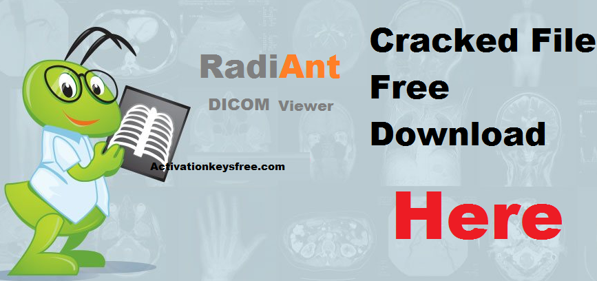 RadiAnt DICOM Viewer 