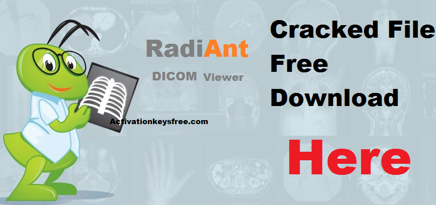 Radiant DICOM Viewer 