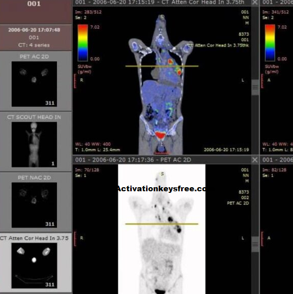 Visualizzatore DICOM RadiAnt 